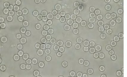 Hoku, blood sample fifteen minutes after the beeem device was used: red blood cells round and separated.