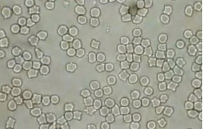 Hoku, baseline blood sample: red blood cells clumped together in compact clusters and short chains.