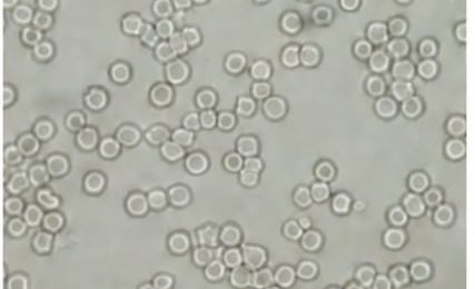 Lani, blood sample fifteen minutes after the beeem device was used: red blood cells round and separated.